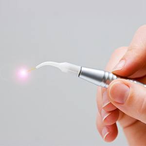 Soft tissue laser dentistry hand tool