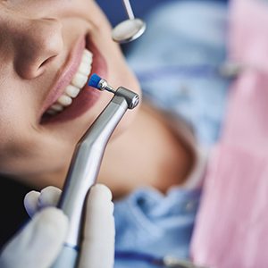 Nose down view of patient having teeth polished