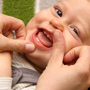 A baby’s teeth erupting through the gum line