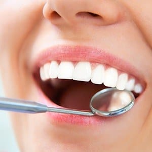 Closeup of healthy smile with metal free dental restorations