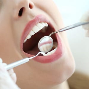 Dental patient receiving a dental cleaning