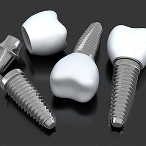 A digital image of three different dental implants lying on a table