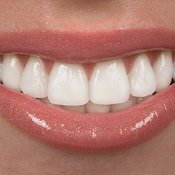 Closeup of healthy smile