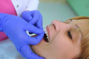 dentist placing temporary veneers on patient