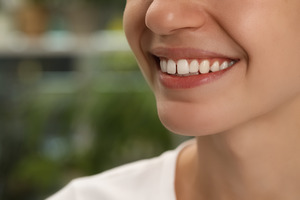 Close-up of woman with gap between front teeth
